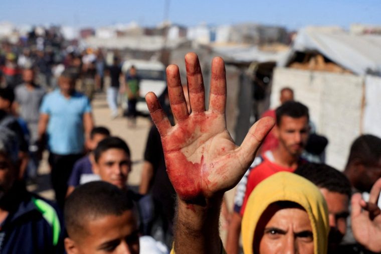 FILE PHOTO: A Palestinian man shows blood stains on his palm after he carried casualties among people seeking aid supplies from the U.S.-backed Gaza Humanitarian Foundation, in Khan Younis, in the southern Gaza Strip, May 29, 2025. REUTERS/Hatem Khaled/File Photo