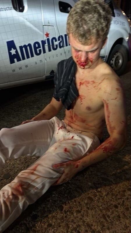 An image of Coristine in the aftermath of the assault that was posted online by President Donald Trump as he called for a crackdown on urban crime in Washington, D.C.