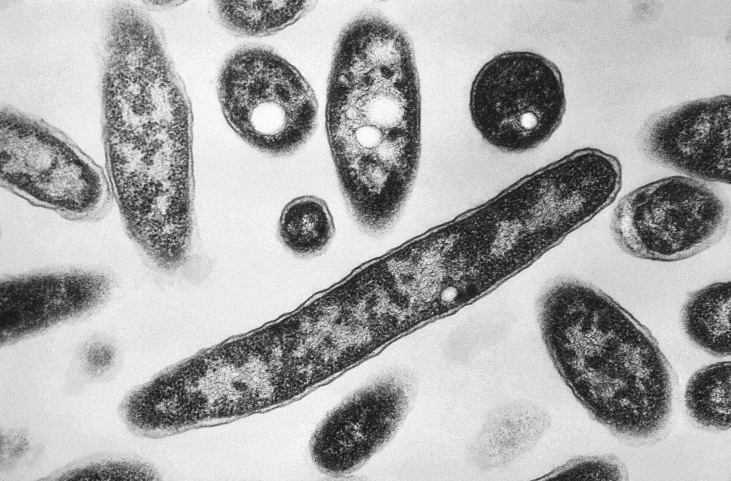 New Yorkers infected with Legionnaires’ disease due to an outbreak in Harlem are gearing up to sue for the ‘preventable’ situation