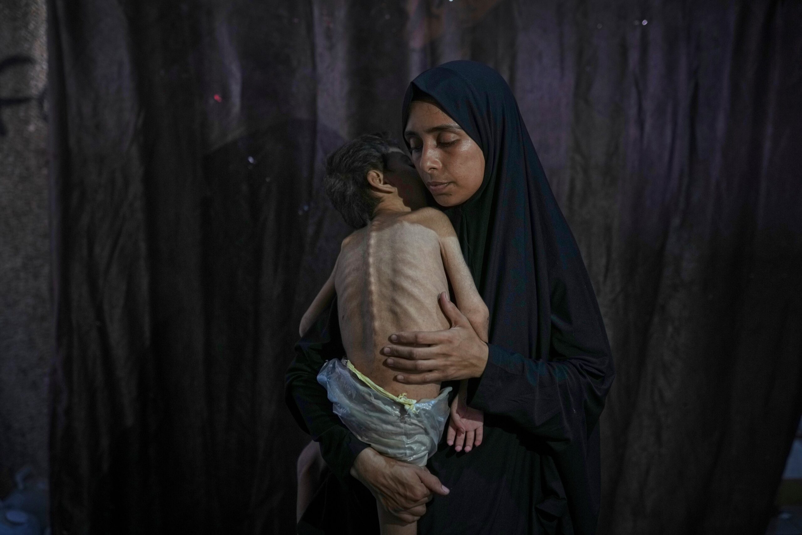 Samah Matar poses for a photo with her son Yousef, 6, who suffers from malnutrition and cerebral palsy at a UN-run school in Gaza City on 26 July 2025