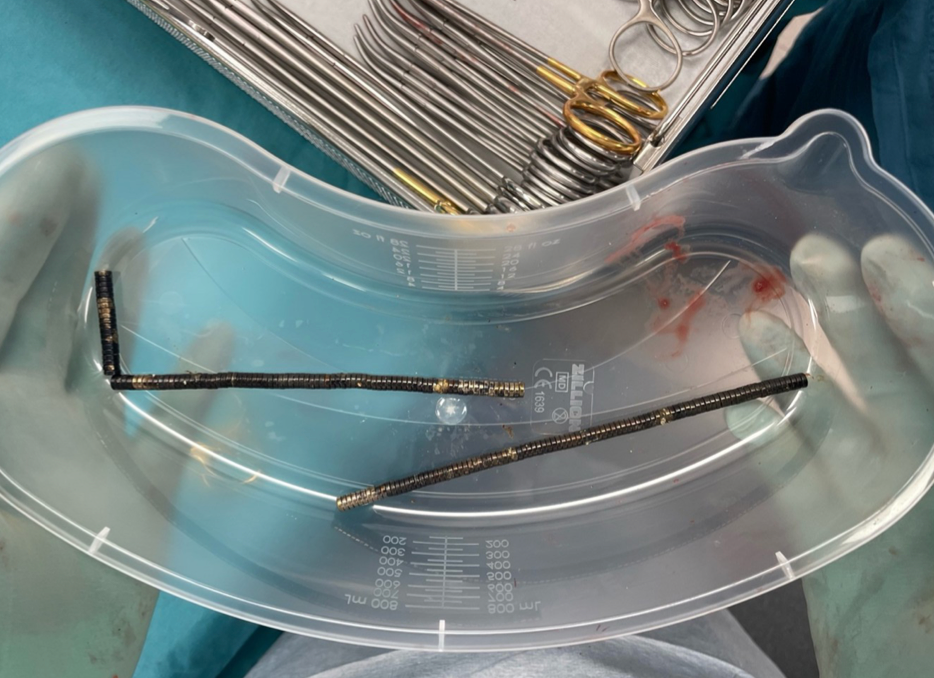 About 80 to 100 high-powered magnets retrieved from operation