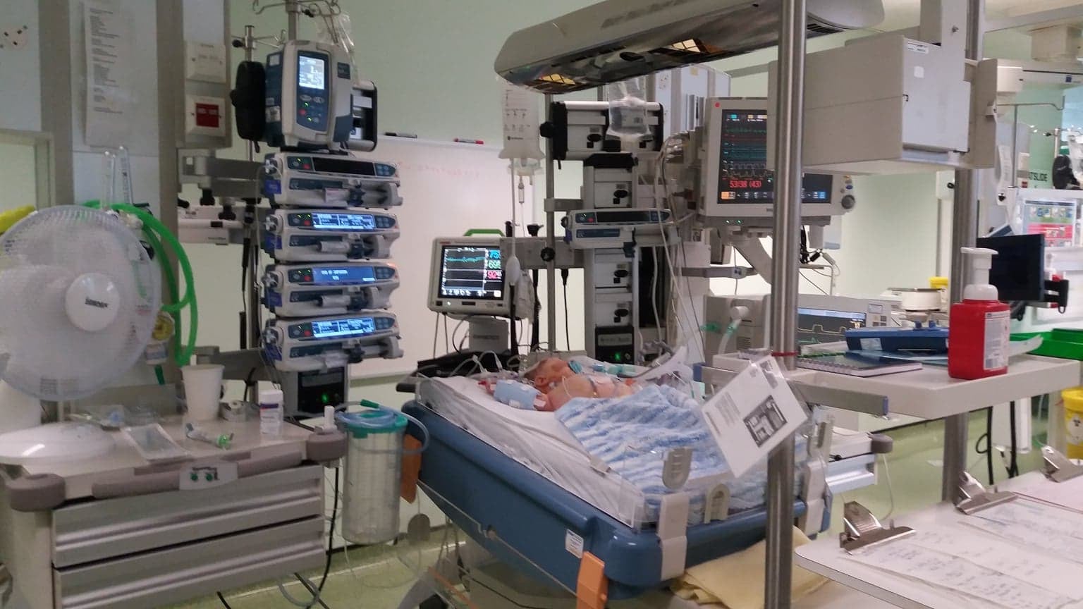 Eddison underwent open-heart surgery when he was just 10 days old