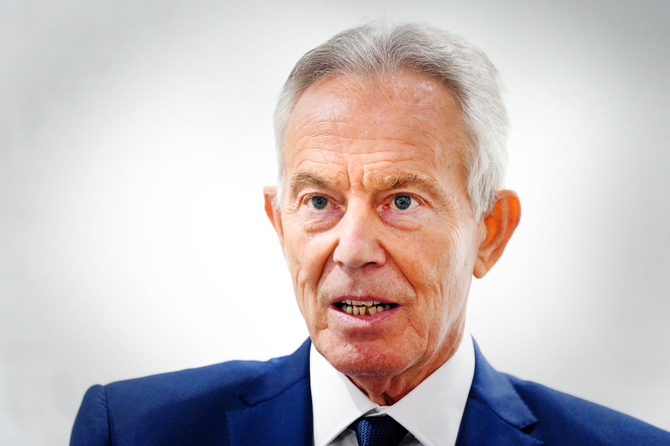 The Tony Blair Institute has now called for any major tax rises to be temporary