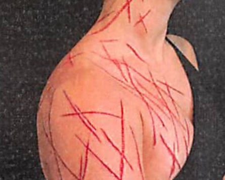 Greene's injuries closely match a detailed set of plans which she gave to a body modification artist