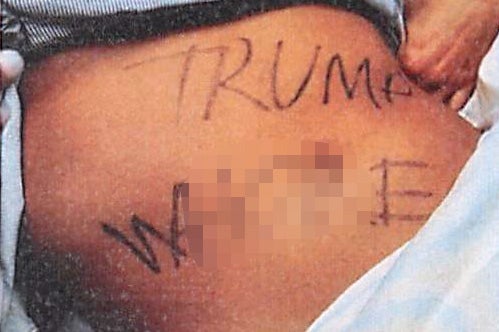 The woman was found with the words “Trump W***e” written across her torso